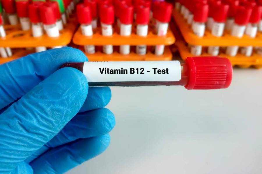 Jak zbadać poziom witaminy K2 w organizmie?